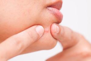 راهکار موثر برای درمان جوش های پوستی
