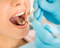 افزایش تعداد دندان‌پزشکان، بهبود شاخص‌های دهان و دندان را در پی ندارد