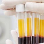 درخواست سازمان انتقال خون از بیماران بهبود یافته کرونا