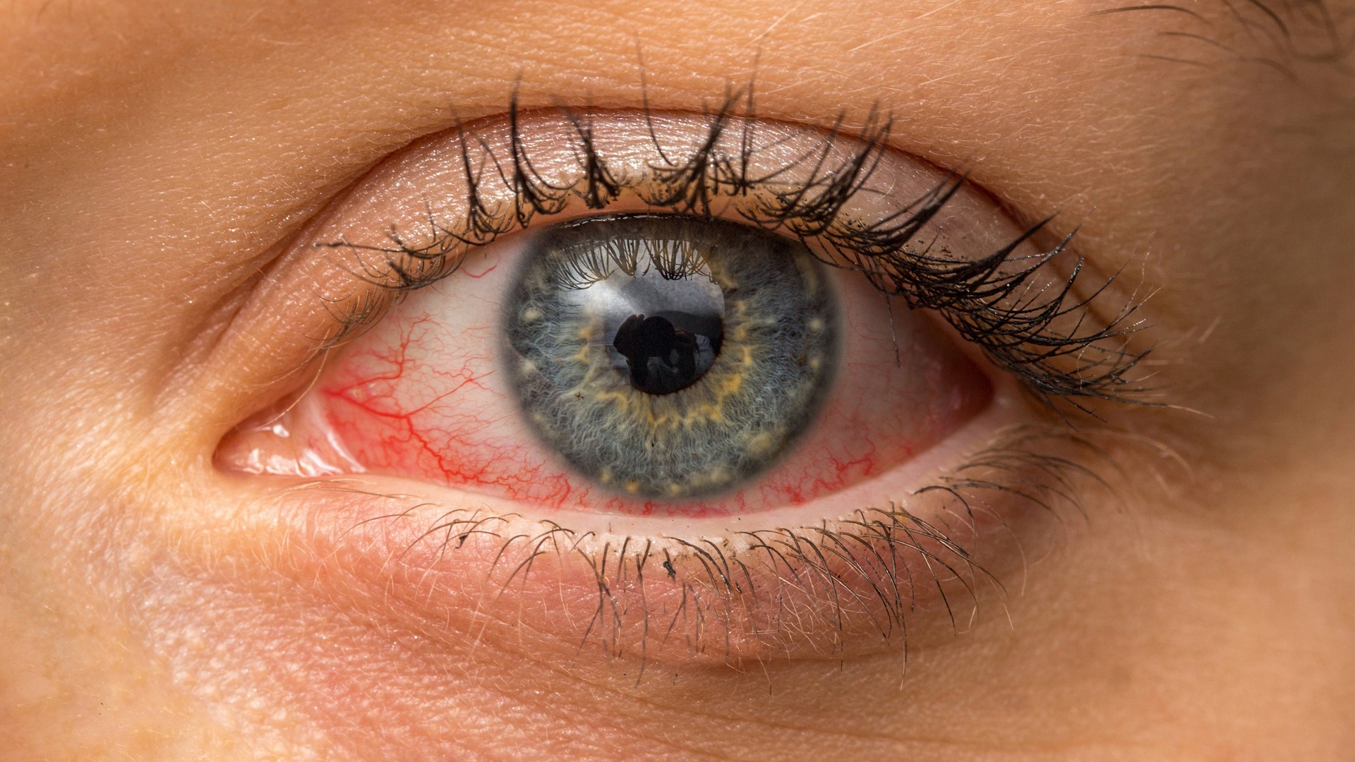 رعایت بهداشت چشم ها برای مقابله با کرونا